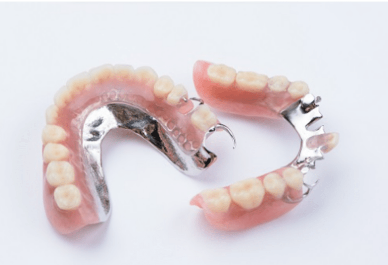 Mind the Gap: Understanding Tooth Replacement Options